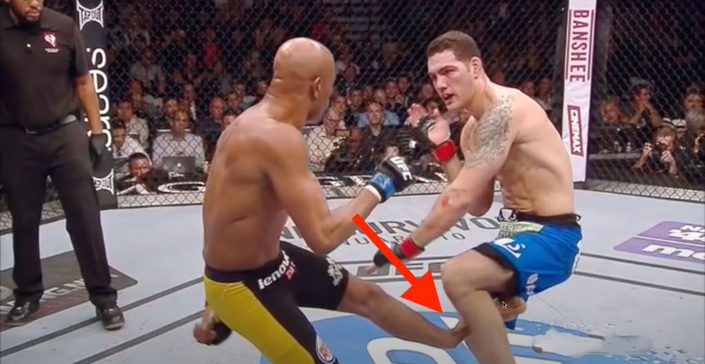 Top 10 Worst Ufc Injuries Ever That Are Disgusting Sports Hub 